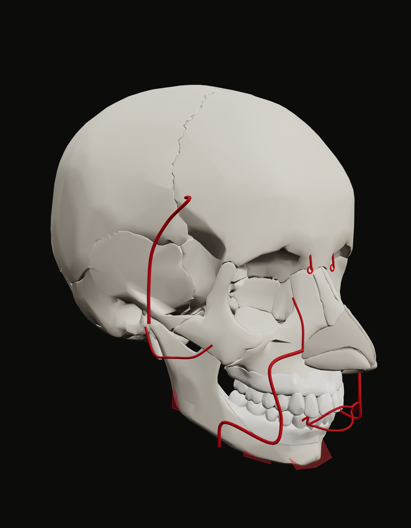 Install anchors on the mandible of the reference skull, three-quarter view, with the mental foramen marked